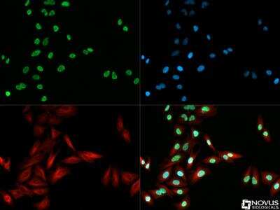 Immunocytochemistry/Immunofluorescence: Histone H3 [ac Lys18] Antibody [NB21-1144] - Histone H3 [ac Lys18] antibody was tested in Hela cells with DyLight 488 (green). Nuclei and alpha-tubulin were counterstained with DAPI (blue) and DyLight 550 (red).